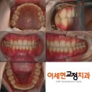 로고스빌딩 | [2년 교정 만족한 솔직후기] 친절하고 세심한 이세현치과