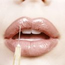 봄날애의원 이미지