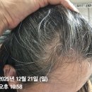 협진약품 | 고잉그레이, 셀프염색