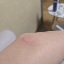 트리하우스 운서 네이버블로그