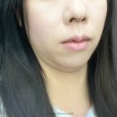 더타임 의료기기 | 슈링크 유지기간 효과 늘린 후기 리프팅기기 내돈내산 뷰티디바이스 홈쎄라로 턱선리프팅