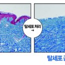 아셀클린