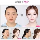 렛미인 - 연수구 | 렛미인