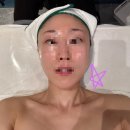 온다움에스테스파 네이버블로그