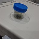 장편한외과의원 | 부천 담낭수술(단일공복강경),인천 담낭수술 후기-성모케이외과의원 2탄