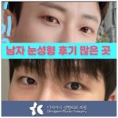 남자눈성형 후기 자연스러운 무쌍눈매교정으로 이미지 변신하는 법