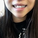 [대구투스젬]toothgem동성로투스젬/투스젬 후기/투스 아티즘