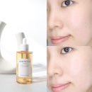 뷰티디렉터손 | 디렉터파이’s pick 수부지 피부 속건조 잡아줄 올리브영 앰플 추천 스킨1004 후기