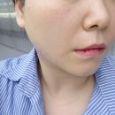 팩트디자인하우스 | 강남역 울쎄라 보톡스 잘하는 곳에서 얼굴라인정리한 후기
