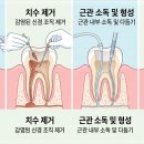뉴욕김치과 네이버블로그