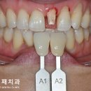 밝은이치과기공소 이미지