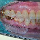 선생님 안녕하세요. 상담 부탁 드립니다. 이미지