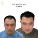 텀즈
