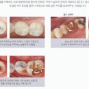 손고운치과의원 네이버블로그