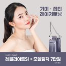 레블라이트SI 레이저토닝 이미지