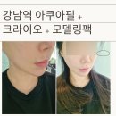 필아쿠아 | 강남역피부과 아쿠아필 솔직후기 크라이오 모델링팩