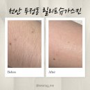 Relief Beauty(릴리프 뷰티) | 천안 슈가링 추천, 두정동 릴리프 슈가스킨에서 왁싱 받고 온 솔직후기