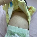 위례 하이엔소아청소년과 입원 후기를 포함한 나의 일기