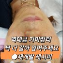 더마트리아 이미지