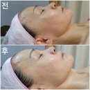 &lt; 칠곡피부관리 / 구미에스테틱 강은미피부관리 &gt; 드라마틱한 효과만점 관리 받고 왔어요!!