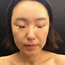 수봄에스테틱수원