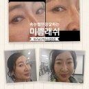 미쁨래쉬