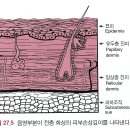 화상의 정도 이미지