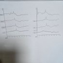 이상연보청기 | 신생아~생후6개월 청력검사후기