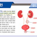 요로결석 증상 여자 남자 원인과 통증 좋은 음식 이미지