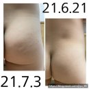 피부가려움증, 피부건조증, 유아아토피보습, 천연성분유아로션, 유아피부보습제 중 으뜸인 아토썸바디...