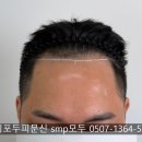 라인헤어 - 중구 다산로28길 57 | 일산헤어라인문신 맨즈헤어라인 후기