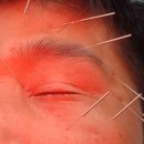 임대웅한의원 이미지