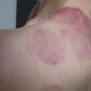 S-TUNE | 국내최초 부황마사지기 한채아 well 웰 247 디바이스 바디컷튠핏 가격 젤 사용방법 실물 후기