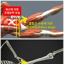사이드킥 이미지