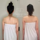 울산 윤곽관리 에프오 에스테틱 얼굴 비대칭 체형관리 제대로