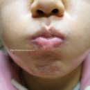 시원메딕스 이미지