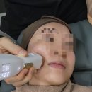 생각과느낌의원 | 덴서티 하이 600 솔직 후기 고덕 슬로아의원