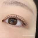 비포앤애프터 | [서현 마이비너스] 수분퐁당 클리닉펌 비포앤애프터 후기