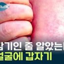 감기 몸살의 증상과 빨리 회복하는 5가지 방법 몸살로 착각하는 질병 이미지