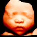 고은빛여성병원 | 입체초음파 고은빛산부인과 고은빛여성병원 베이비페이스 실물비교 비용 후기