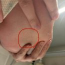 우리척병원 | 성북우리아이들병원 신생아 엉덩이 털 딤플 초음파 당일검사 가격 후기