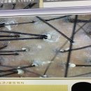 비타브리드스칼프케어 이미지