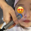 진해의원 | 진해피부과 바ㅇㅇ의원 LDM 물방울 리프팅 관리 효과 후기