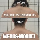 에어투자관리(주) | 향남뷰티비 / 산후·통증 케어까지 에어바디 관리 리뷰