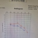 보청기 지원금 못받는다고하는데.. 이미지