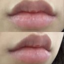 6209 | 투엠메이크업[반영구센터] 강남무통반영구 입술문신 착색입술 중화 내돈내산 후기