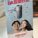 강진베스트치과의원 | 임플란트 무서워서 5년을 미룬 쫄보의 후기 (feat.김포베스트치과의원) 내돈내산