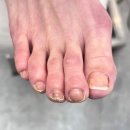 문제성 손, 발 오감네일 이미지