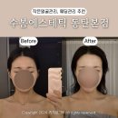 이화정비기기 | 동탄 얼굴윤곽관리 추천, 작은얼굴 관리 '수봄에스테틱 동탄본점'
