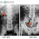 신장축산 네이버블로그